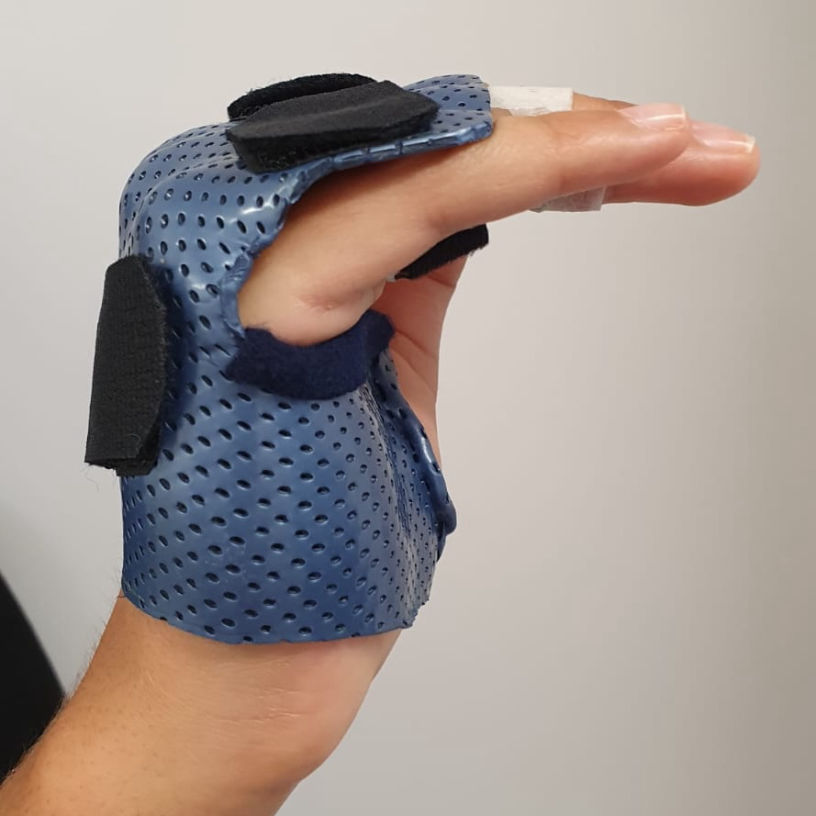 Splint
